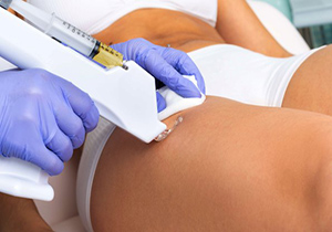 Tratamiento de mesoterapia
